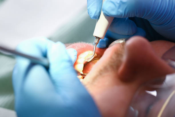 Best Emergency Dentist for Lost Fillings or Crowns in Rolling Meadows, IL