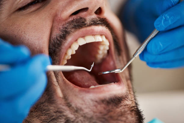 Best Mobile Emergency Dentist in Rolling Meadows, IL